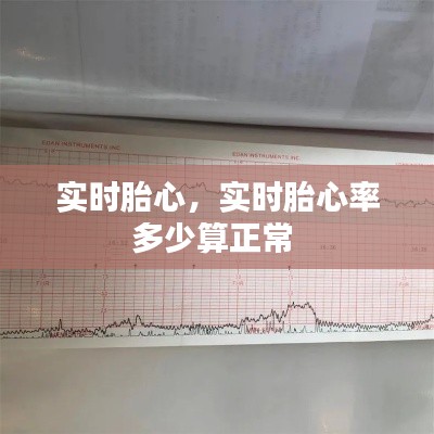實時胎心，實時胎心率多少算正常 