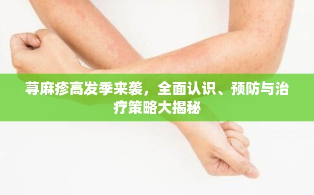 蕁麻疹高發(fā)季來襲，全面認識、預防與治療策略大揭秘
