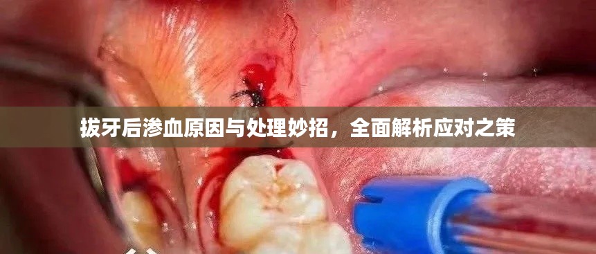 拔牙后滲血原因與處理妙招，全面解析應(yīng)對之策