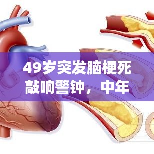 49歲突發(fā)腦梗死敲響警鐘，中年人健康危機不容忽視