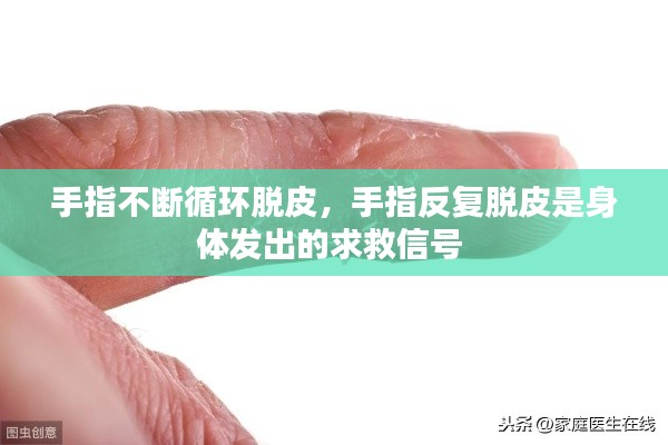 手指不斷循環(huán)脫皮，手指反復(fù)脫皮是身體發(fā)出的求救信號(hào) 