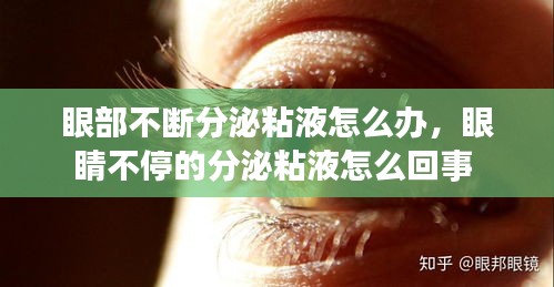 眼部不斷分泌粘液怎么辦，眼睛不停的分泌粘液怎么回事 