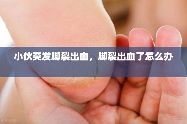 小伙突發(fā)腳裂出血，腳裂出血了怎么辦 